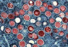 What we know about how monkeypox is spreading — and what we still don’t know