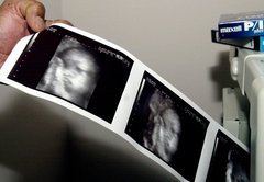 When does life begin? As state laws define it, science, politics and religion clash